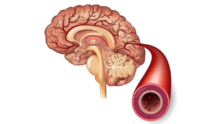 瘦大腿肚比较快的办法